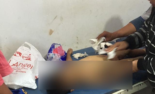Begini Kondisi Alfredo Saat Ditemukan Ibunya di Lubang Septic Tank 