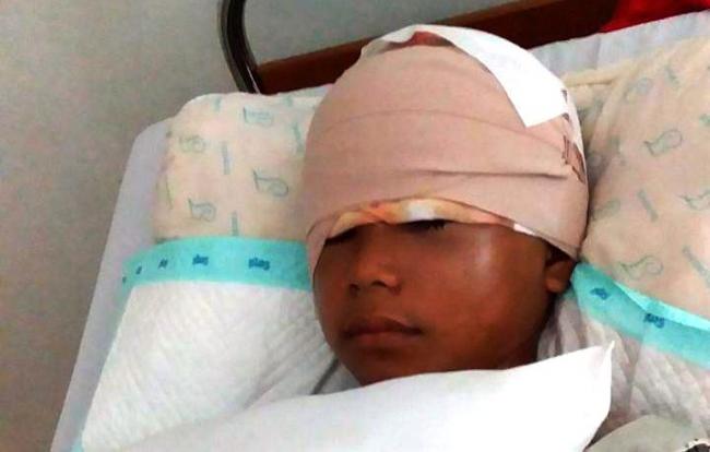 Ini Kata Dokter Bedah Terkait Kepala Gadis Lingga yang Terkuliti