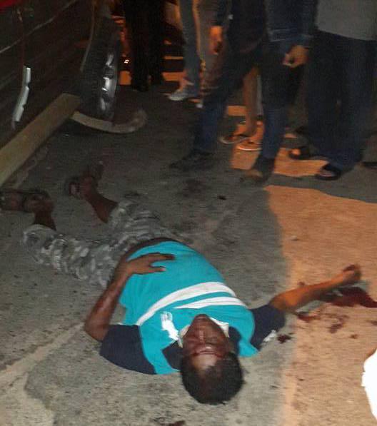Warga Singapura si Sopir Maut Alami Retak di Kepala 
