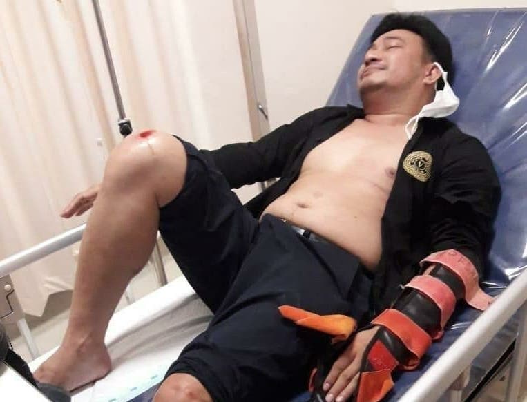 Mantan Anggota DPRD Helmy Hemilton Dikeroyok di Harbour Bay Hingga Patah Tulang