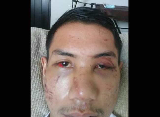 Korban Pengeroyokan Enam Polisi Minta Uang Damai Rp 180 Juta
