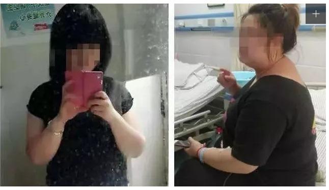 Ketagihan Pil Pelangsing, Wanita Ini Berat Badannya Naik 2 Kali Lipat