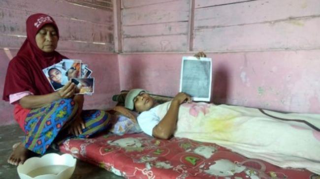 Anggota DPRD Dipolisikan, Cabut Kuku Warga Miskin Pakai Tang