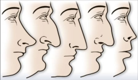 10 Bentuk Hidung Cerminkan Kepribadian Anda