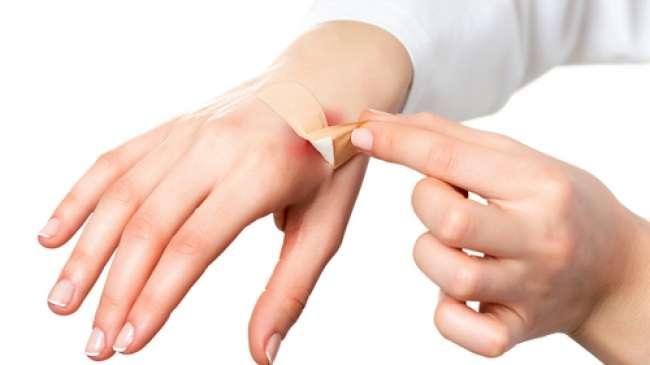 3 Tips Hilangkan Luka Memar dengan Lebih Cepat
