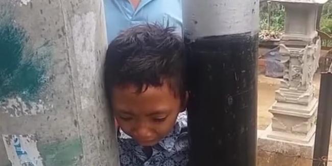 Viral Kepala Bocah Terjepit di Antara Dua Tiang Listrik