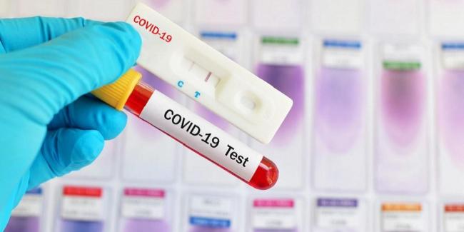 Rapid Test Ditetapkan Maksimal Rp 150 Ribu, Bagaimana Faktanya?