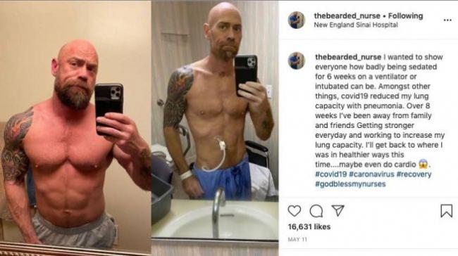 Terinfeksi Covid-19, Berat Badan Perawat Ini Susut 23 Kilogram