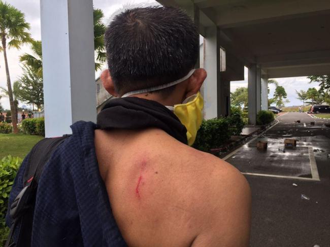 Stringer TV One Terluka Kena Pentung Rusuh Demo di Tanjungpinang