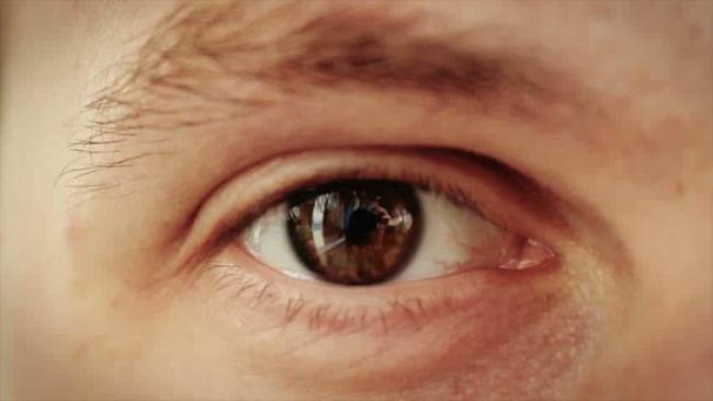 Pekan Glaukoma Dunia: Siapa Saja yang Berisiko Terkena?