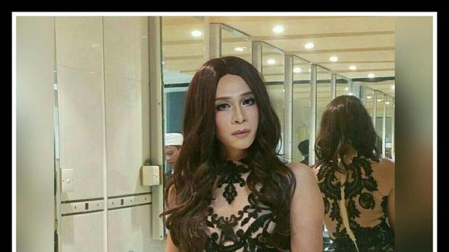 Aming Ganti Kelamin Jadi Perempuan? Ini Jawaban Managernya