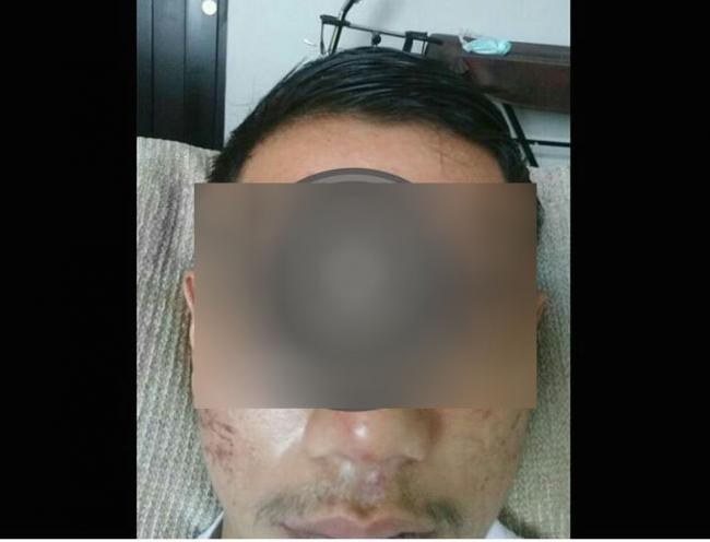 Dua Orang Pria Babak Belur, Korban: Kami Dihajar Oknum Aparat seperti Binatang