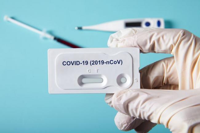 Rapid Test: Seorang Staf ATB Reaktif Covid-19