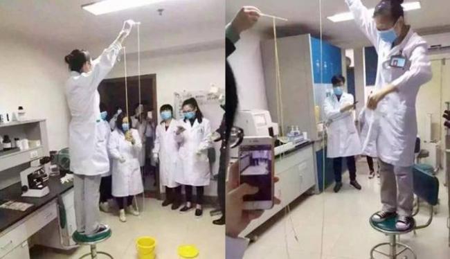 Dokter Keluarkan Cacing Pita Babi 2,5 Meter dari Perut Seorang Pria
