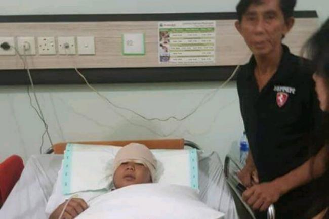 Kabar Terbaru Gadis Lingga Korban Kulit Kepala Terkelupas