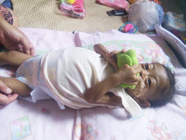 Jurnalis di Bintan Bantu Bayi Penderita Penyakit Langka