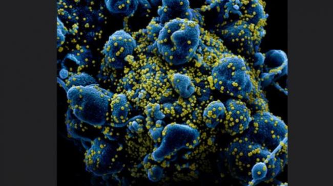 Ngeri, Ilmuwan China Temukan Bukti Virus Corona Bertahan di Udara