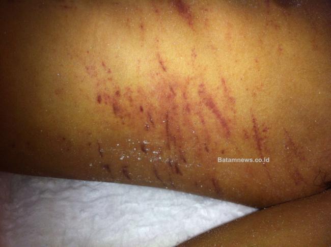 Kematian Mencurigakan Tahanan Narkoba di Rutan Diduga Sengaja Ditutupi