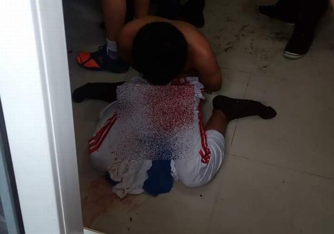 Pelaku Bom Bunuh Diri Kejar Pastor ke Mimbar Gereja Santo Yoseph Medan