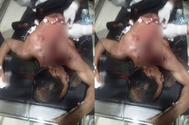 Dituduh Maling, Pria di Bintan Ini Kritis Disabet Parang