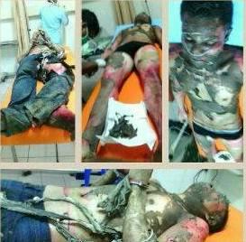 Mengerikan! Foto-foto Korban Kekejaman Oknum Polisi di Karimun Beredar di Medsos