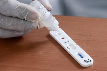 Harus Diulang, Rapid Test Tak Cukup Sekali!