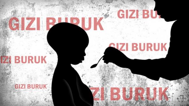 Kecamatan di Bintan Ini Terbanyak Kasus Gizi Buruk