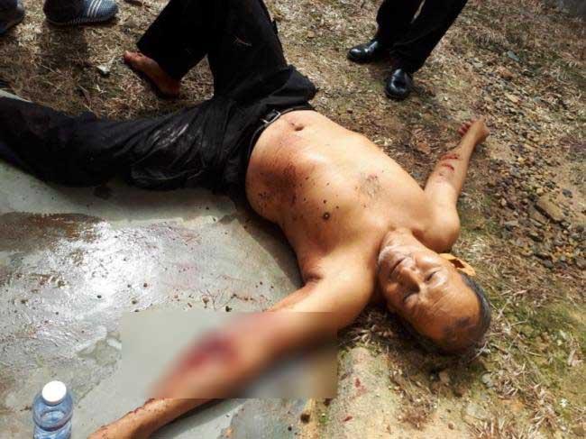 Pria Singapura Bersimbah Darah di Tiban
