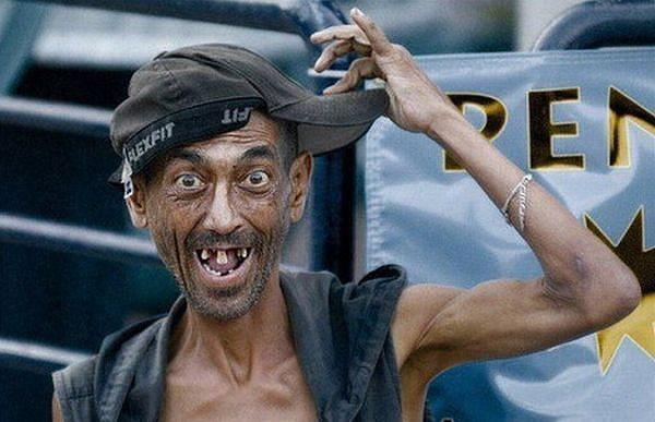 Banyak Orang Gila `Wajah Baru` Menggelandang di Karimun