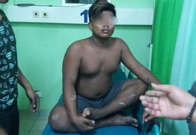Diserang Geng Motor, Dua Pemuda di Karimun Nyaris Tewas