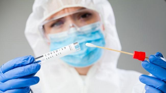 Medilab dan RSAB Ditunjuk Jadi Pelaksana PCR Test untuk TCA