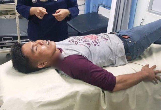 Polsek Batuampar Buru Pembegal Pelatih Taekwondo di Seraya