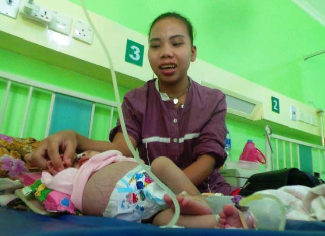 Derita Putri Aisyah, Bayi 2 Bulan yang Harus Buang Air dari Mulut