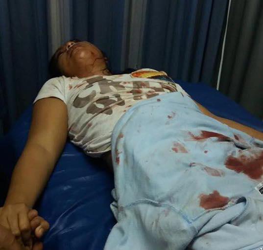 Pelaku Penganiayaan di Kampung Utama Pernah 5 Kali Gagal Bunuh Diri 
