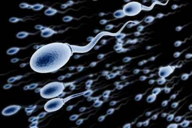 Kenali Ciri-ciri Sperma yang Sehat, Mulai dari Warna hingga Kekentalan