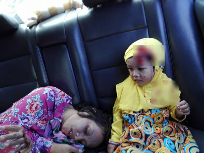 Ibu Guru dan Balita yang Kecelakaan di Tiban Ini Bikin Netizen Terharu