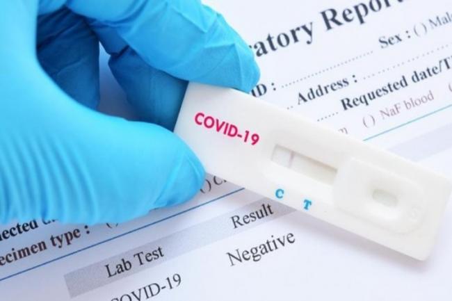 Kontak dengan 3 Pasien Corona, 28 Warga di Karimun Jalani Rapid Test