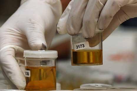 Ratusan Personel Jajaran Polresta Barelang Dites Urine, Dua Orang Positif 