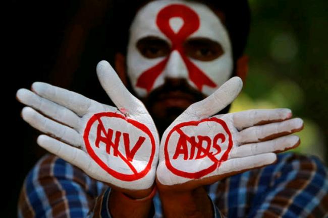 Dinkes Catat Ada 11 Penderita HIV/Aids di Lingga Tahun Ini
