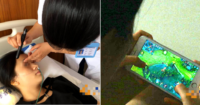 Gadis 21 Tahun di Cina Mengalami Kebutaan Setelah Main Mobile Legend