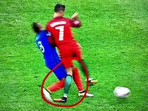 Penampakan Horornya Tabrakan Ronaldo dengan Dimitri Payet