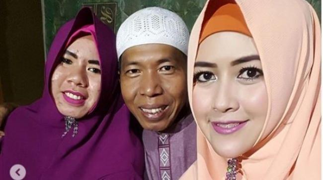 Kiwil Mau Nikah Lagi, Begini Kata Istri Kedua