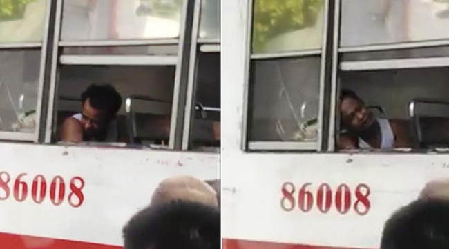Tragis, Pria Filipina Kehilangan Tangannya Saat Tertidur di Dalam Bus