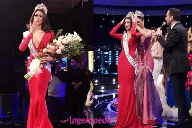 Kulit Tampak Mulus, Wajah Kontestan Miss Universe Ini Ternyata Rusak