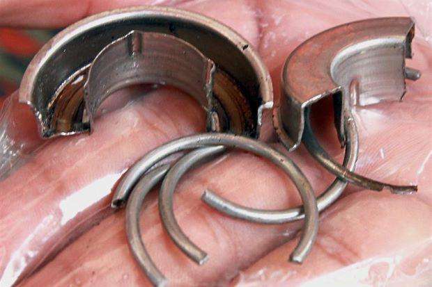 Alamak, Kemaluan Pria Malaysia Ini Terjebak di Cincin 12 Jam