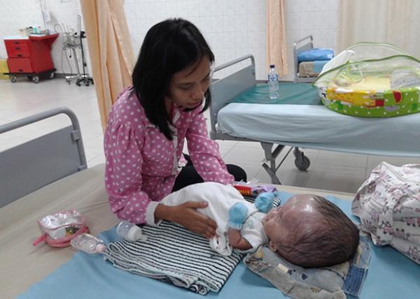 Mengharukan, Kisah Sri Ismiyanti Menangis 3 Hari 3 Malam Mendengar Bayinya Menderita Hidrosepalus