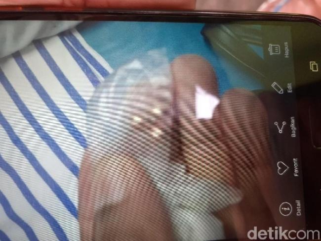 Diberondong 10 Tembakan, 2 Peluru Bersarang di Kepala Pedagang Kopi