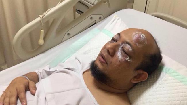 Jokowi Minta Polri Usut Tuntas Penyiraman Air Keras ke Novel Baswedan