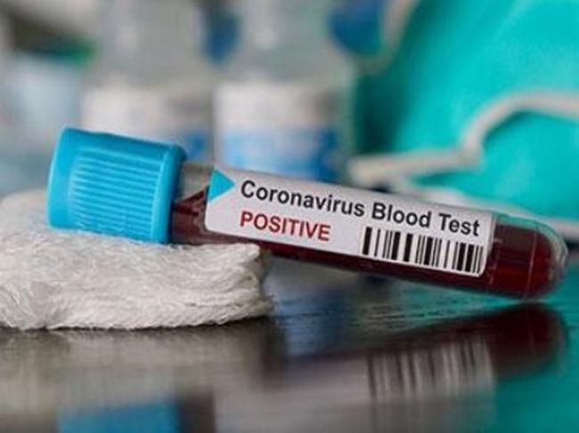 Satu WNI Positif Virus Corona usai Tiba di Singapura