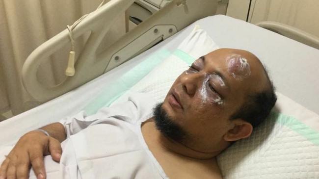 Novel Baswedan Disiram Air Keras Pulang Salat Subuh